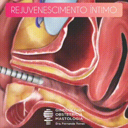 rejuvenescimento intimo