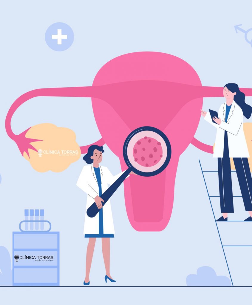 sindrome urogenital