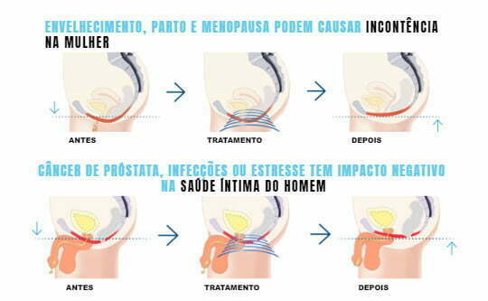 cadeira emsella