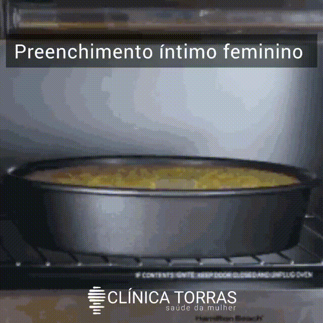 preenchimento intimo feminino