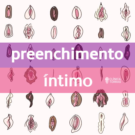 preenchimento intimo