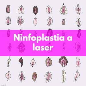 ninfoplastia