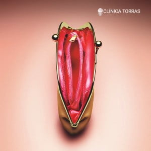 ninfoplastia dúvidas Ninfoplastia mitos